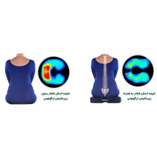زیرنشیمنی طبی مدل پلی یورتان کد 8018 102700094